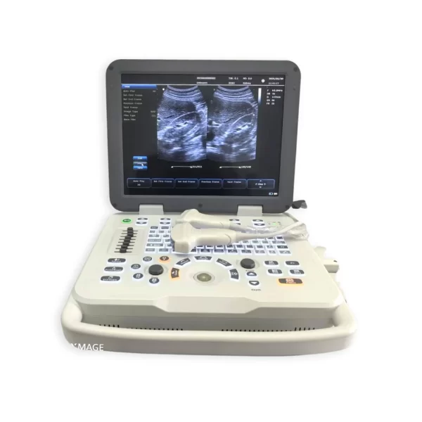 notebook color doppler