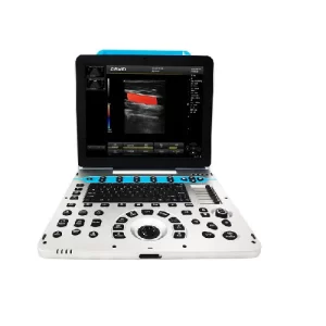 Veterinary Sonography Machine P3