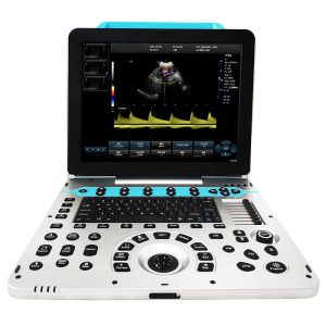 Veterinary Ultrasound Machine